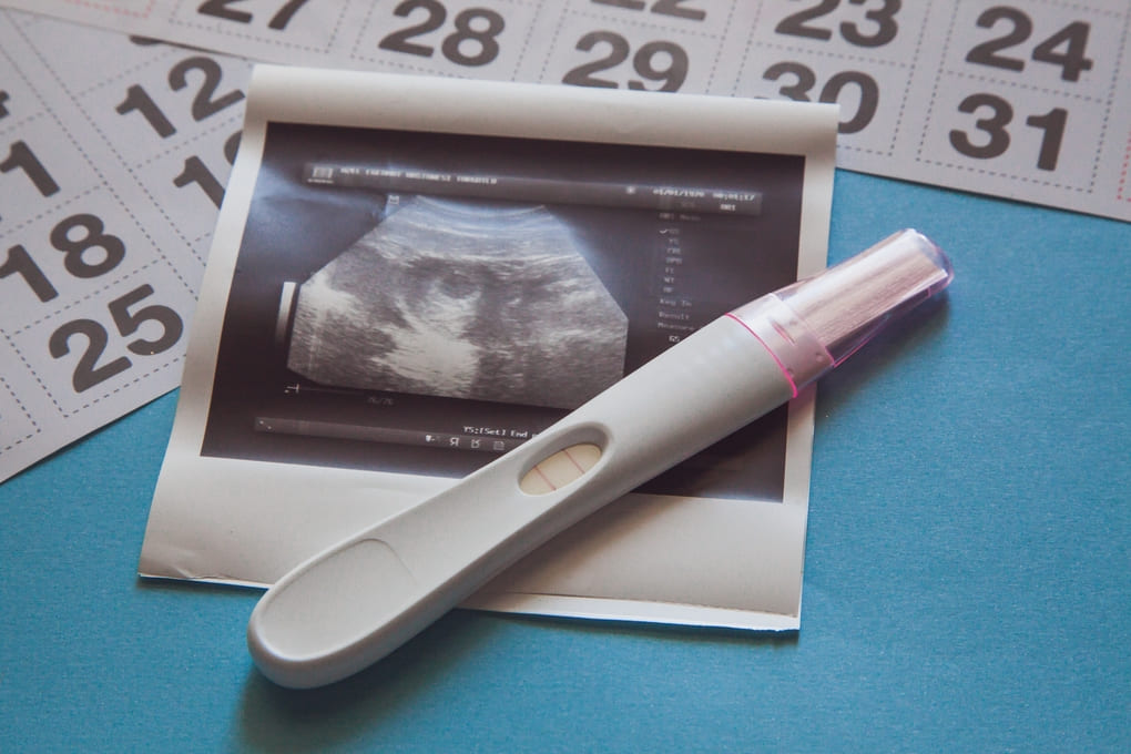 Tratamiento de fertilidad con clomifeno: guía práctica para personas en  Honduras